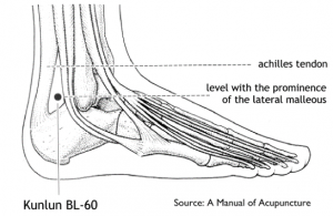 Bladder 60 point for labour induction