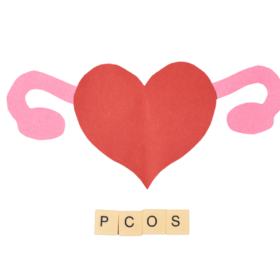 PCOS and Fertility