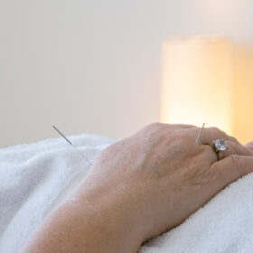Acupuncture Caroline Springs